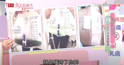 女人的乳頭|乳暈上有「小顆粒」正常嗎？乳暈顏色和別人不一樣？女孩到女人。